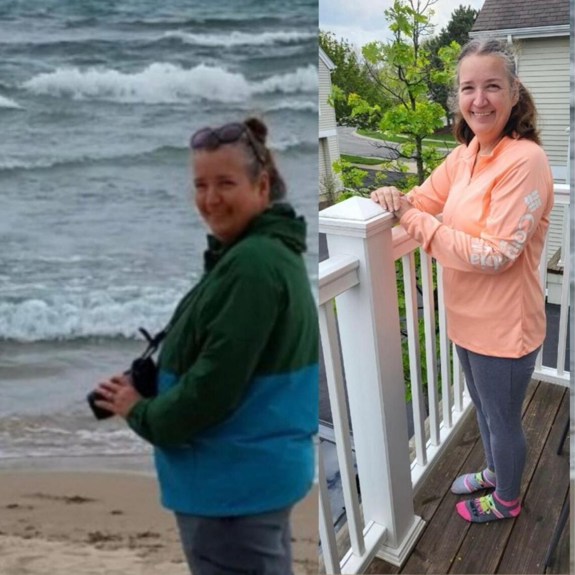 Female Patient - Before and After - Advanced Practice Health Institute - Des Plaines